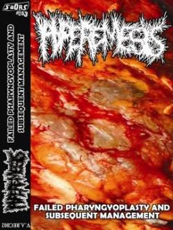 Hyperemesis : Failed Pharyngyoplasty and Subsequent Management